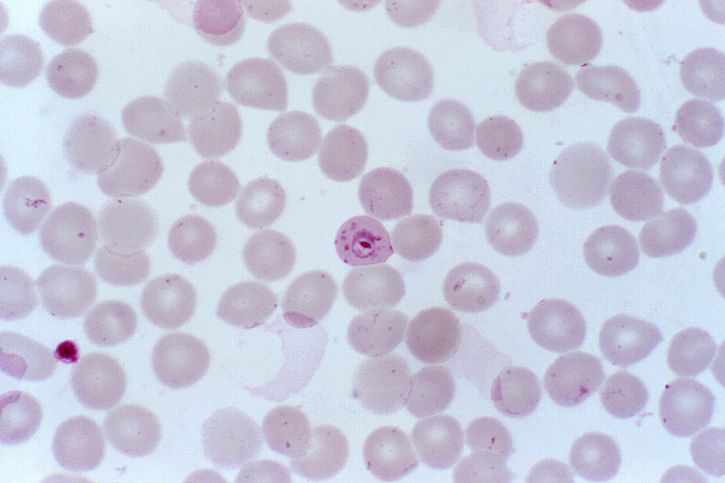 Plasmodium falciparum, anéis, delicados, citoplasma, pequena, cromatina, pontos, infecção, hemácias, ampliado