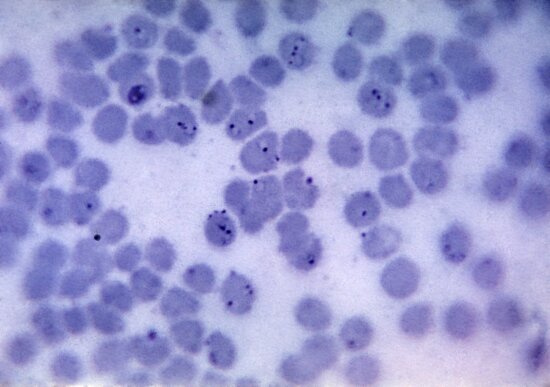 Image libre plasmodium vivax trophozoites grande quantité amiboïde cytoplasme