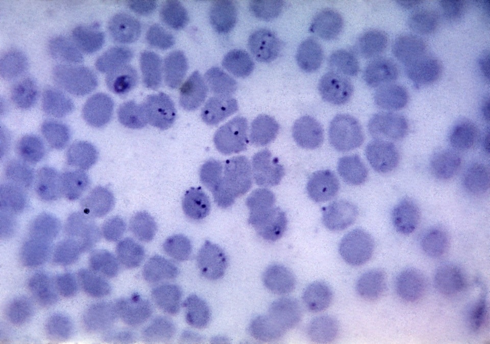 Kostenlose Bild Plasmodium Falciparum Schizonten Zwei Erythrozyten Wrights Flecken X