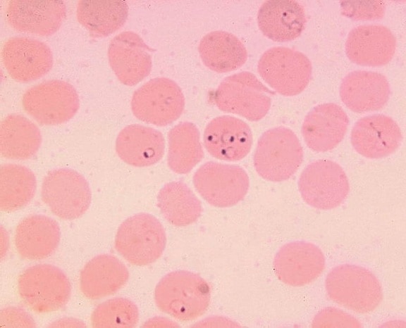 Plasmodium falciparum, anillos, eritrocitos, frotis de sangre, parásito