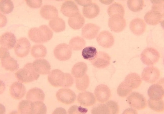 Plasmodium malariae, erytrocyter, protozoon, parasit