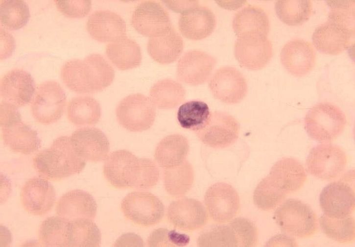Plasmodium malariae, hồng cầu, protozoon, ký sinh trùng