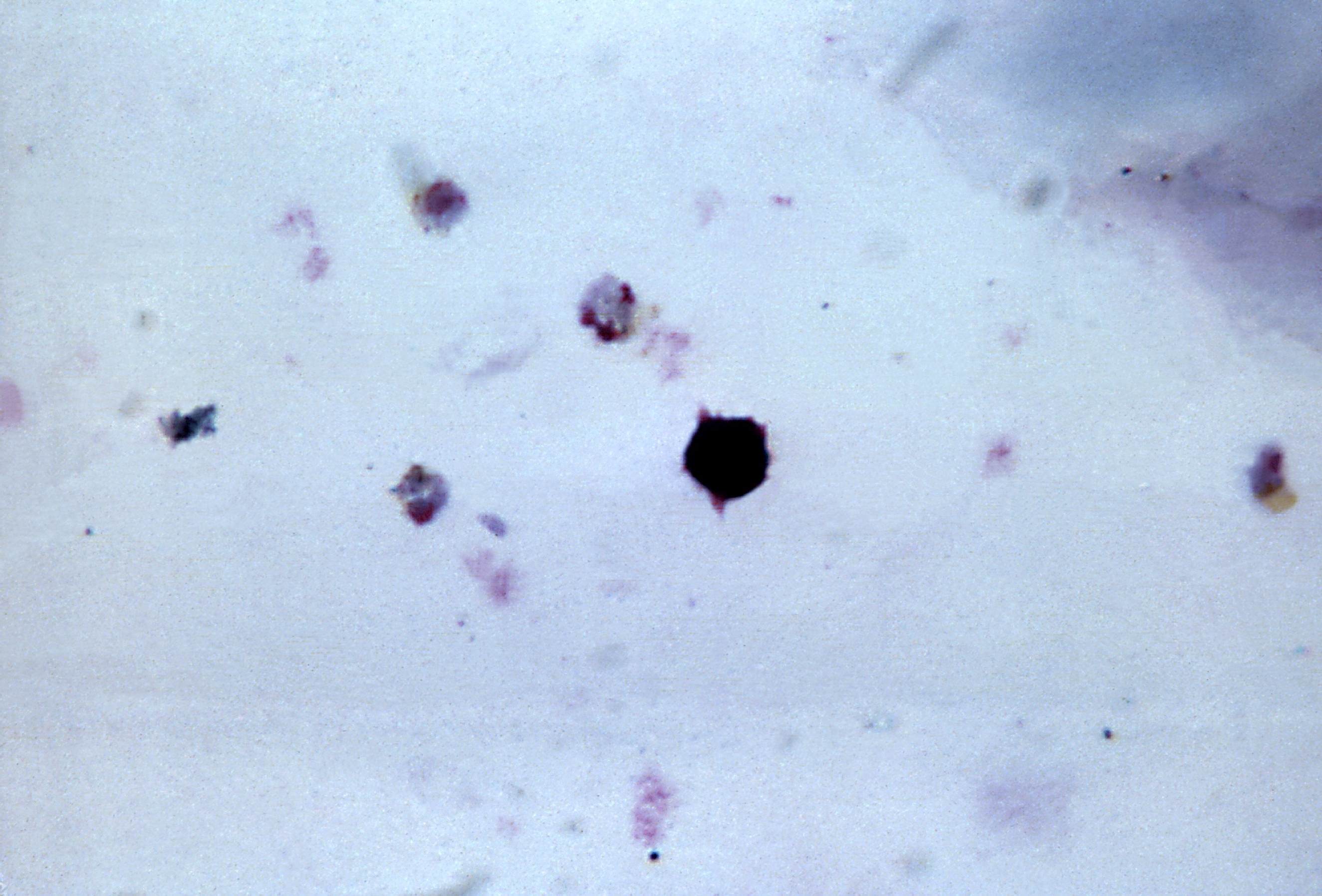Многочисленные мелкие тельца. Малярийный плазмодий под микроскопом. Слизевик плазмодий.