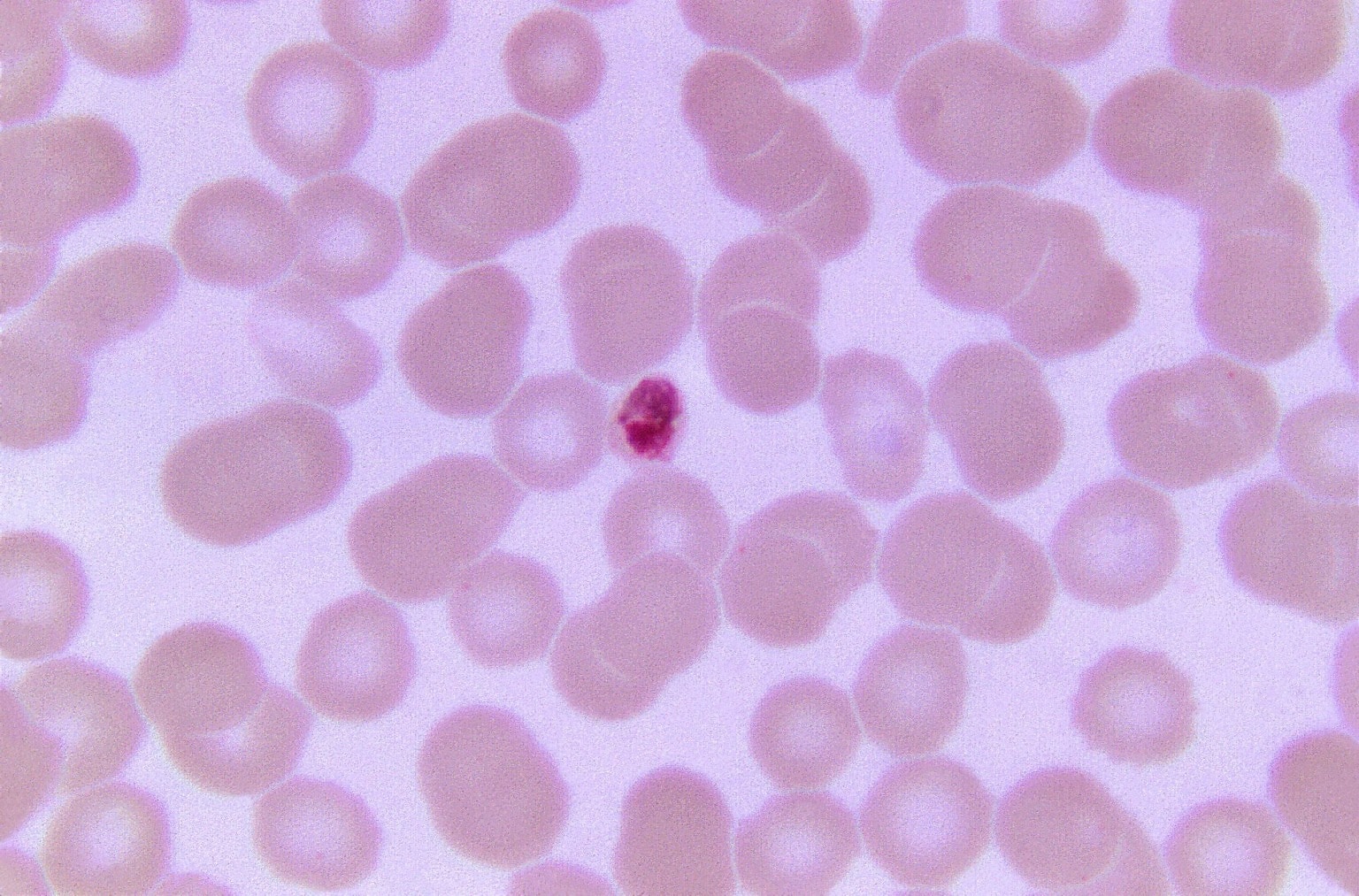 Free Picture Plasmodium Malariae Trophozoite Small Stain