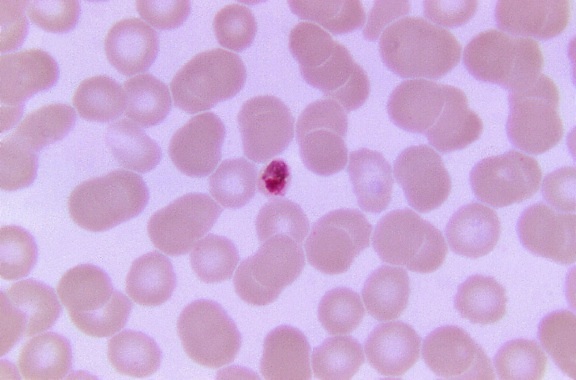plasmodium malariae, trophozoite, small, stain