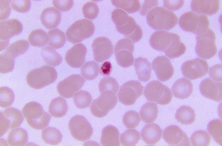 Plasmodium malariae, trophozoite, klein, Fleck