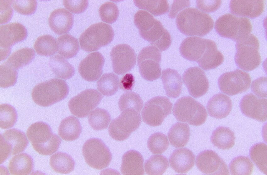 Free picture: plasmodium malariae, trophozoite, small, stain