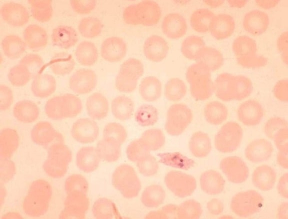 Plasmodium ovale, ringar, dubbelt, infektion, erythocyte