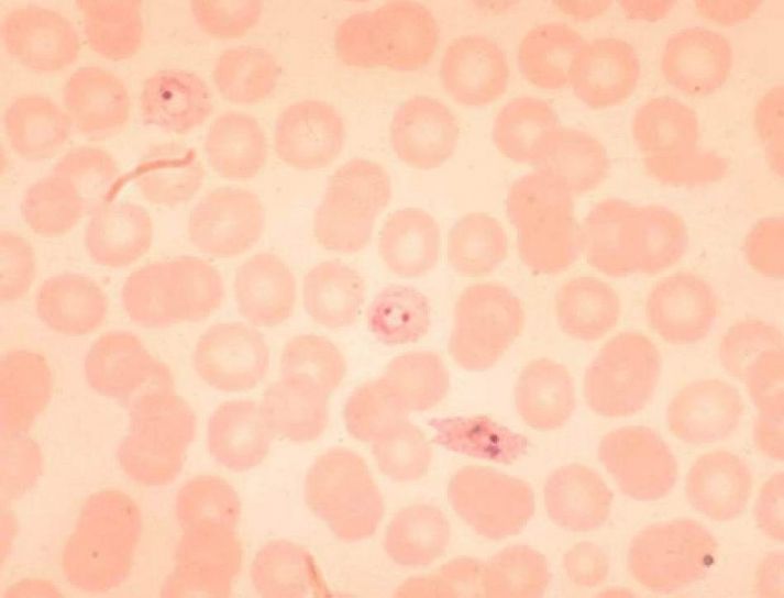 Plasmodium ovale, renkaat, kaksin verroin, infektio, erythocyte