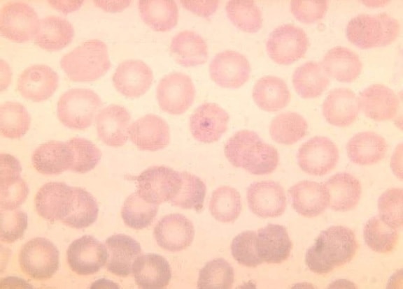 Plasmodium ovale, joven, anillo, parásito