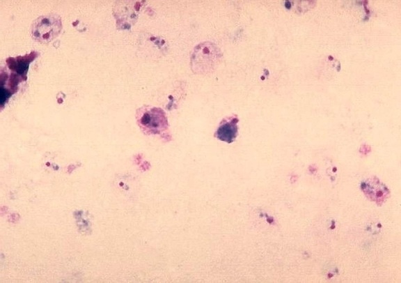 Plasmodium vivax, gametocyte, Зрелые, трофозоита, паразит