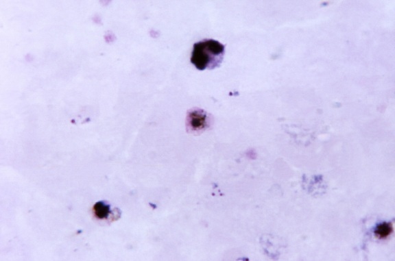 Plasmodium vivax, gametocyte, rossiccio, colore, esposizione, virtualmente, visibile, il citoplasma