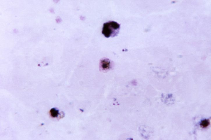 Plasmodium vivax, gametocyte, crvenkasto, boja, prikaz, gotovo, vidljive, citoplazma