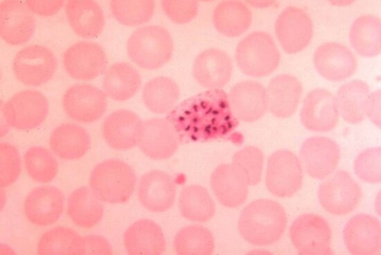 Free Picture Micrograph Two Vivax Trophozoites Fused Platelets Magnified X