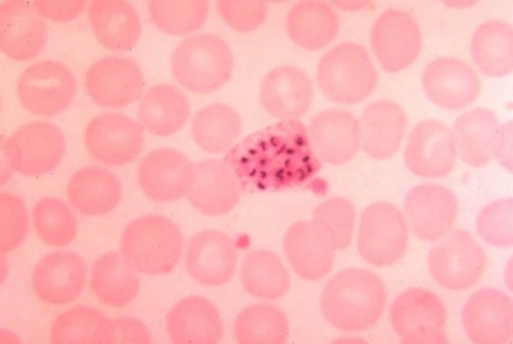 Plasmodium vivax, immaturo, schizonte, striscio di sangue, parassiti