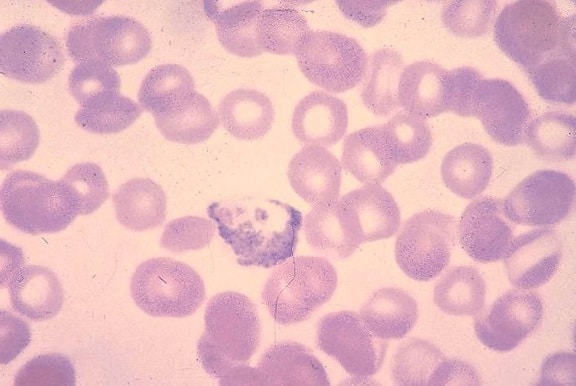 Plasmodium vivax, zralé, macrogametocyte