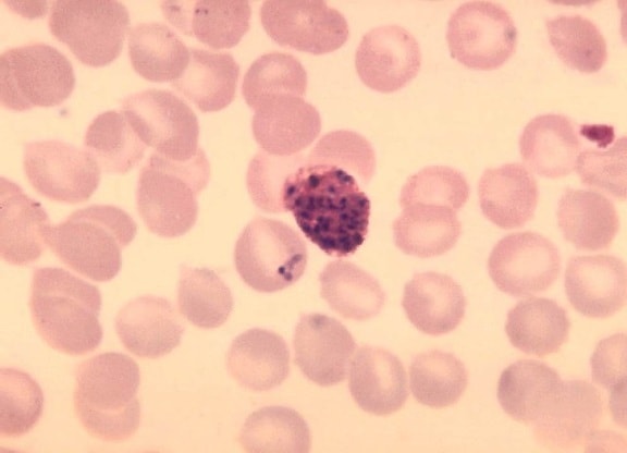 plasmodium vivax, mature, schizont, merozoites, parasite