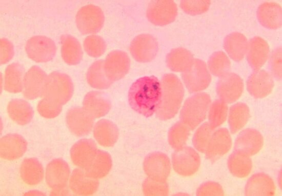 Kostenlose Bild Mikrophotographie Plasmodium Malariae Trophozoite Ring B Hne Wrights