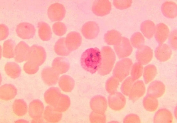 parazit Plasmodium vivax, zrelý, schizont, krvného náteru