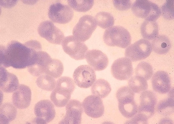 Plasmodium vivax, l'anello, la forma, trofozoite, eritrociti, spettacoli, basofili, punteggiatura