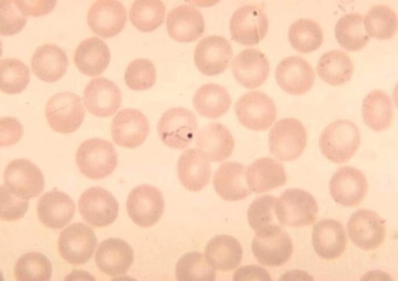 Plasmodium vivax, ring, erytrocyt, parasit