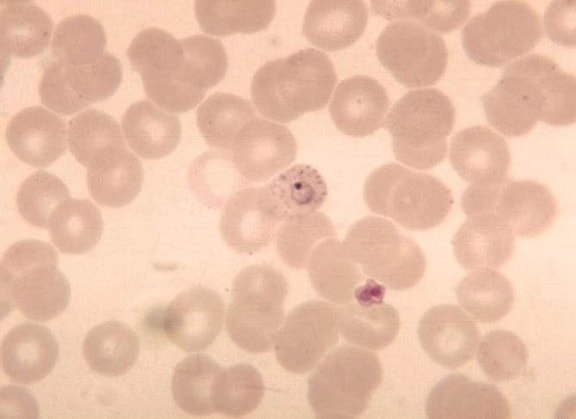 Plasmodium vivax, anillo, punteado, de eritrocitos