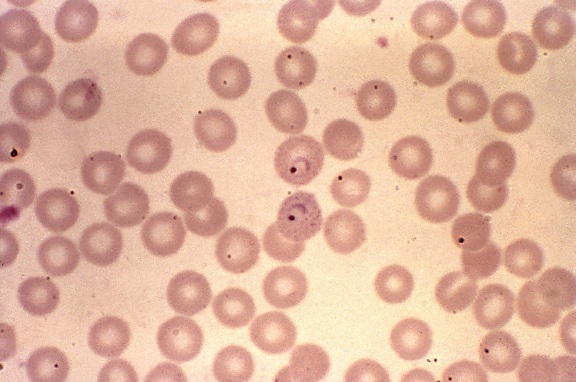 plasmodium vivax, anneaux, grand, chromatine, points, spectacle, amiboïde, cytoplasme, develo