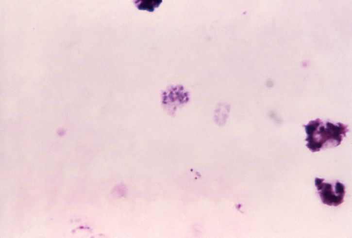 Plasmodium vivax, schizonts, powiększone, może zniekształcony