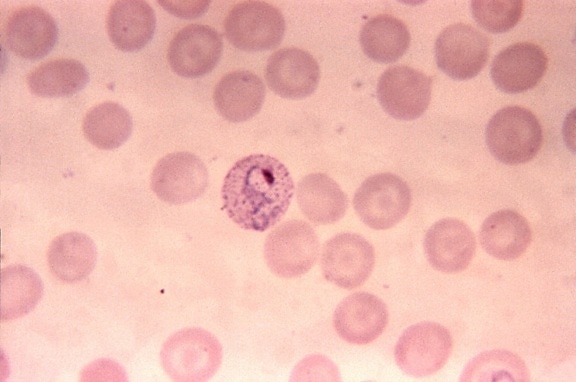 Plasmodium vivax, трофозоита, кровь, smea