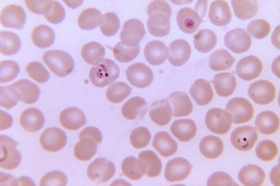 plasmodium vivax, trophozoite, contained, three, chromatin, dots