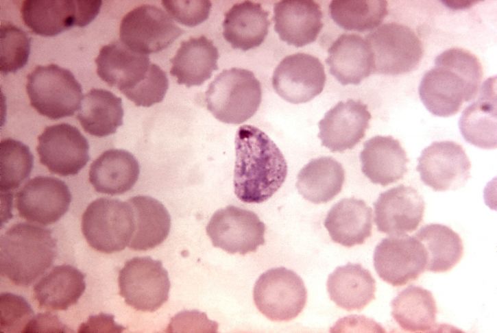 Plasmodium vivax, trophozoites, velika količina, ameboid citoplazma