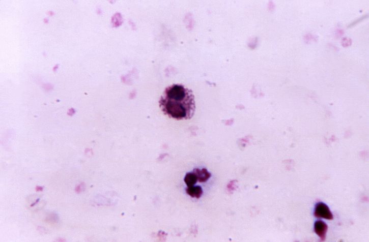 แสดงตน มืด ๆ เม็ด eosinophil ชนิด ขาว เลือด เซลล์