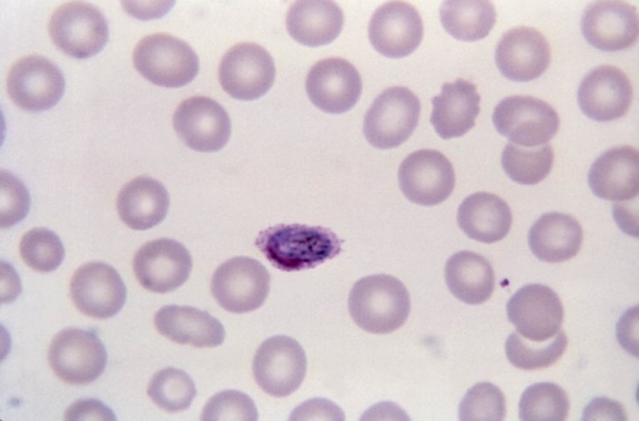 赤血球は、通常、わずかに拡大、ラウンド、楕円形で、時に、線毛保有