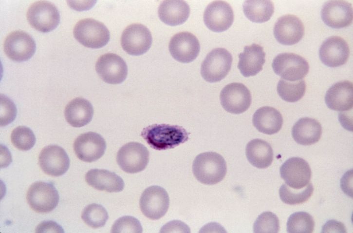 sel darah merah, normal, sedikit, diperbesar, bulat, lonjong, kadang-kadang, fimbriated