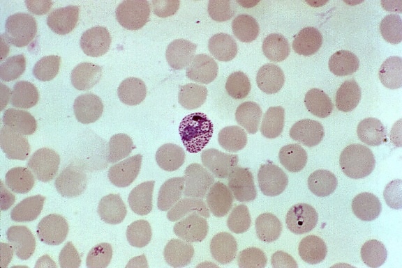 Crveni, krvi, stanica, infekcija, plasmodium vivax, zrela, trophozoite, prva faza