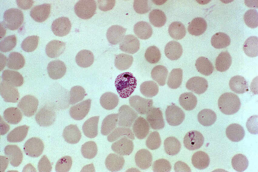 free-picture-red-blood-cell-infection-plasmodium-vivax-mature