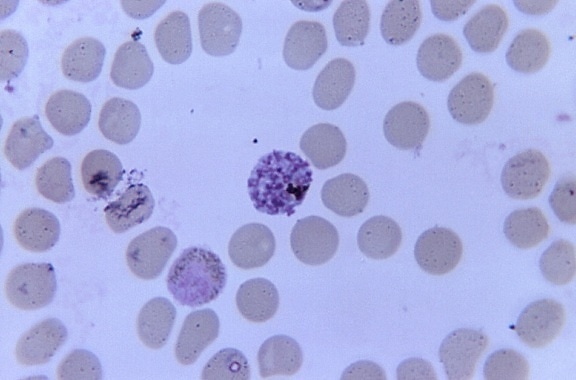 simian, 혈액 샘플, 존재, 성숙, 유인원, 말라리아, schizont, gametocyte