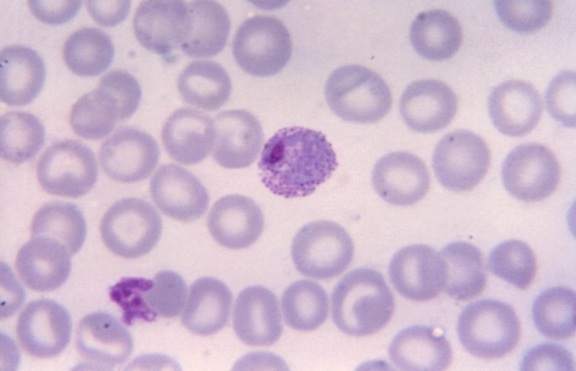células, tejidos, micrografía, madura, Plasmodium vivax, trophozoite