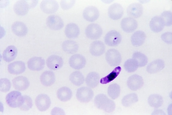 男性 microgametocytes、女性 macrogametocytes、摂取、ハマダラカ蚊、血、食事