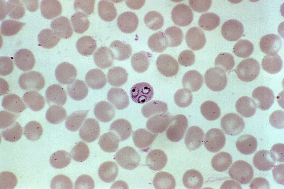 máxima, tamaño, rojo, sangre, células, infección por Plasmodium vivax, oscila, intermediarios