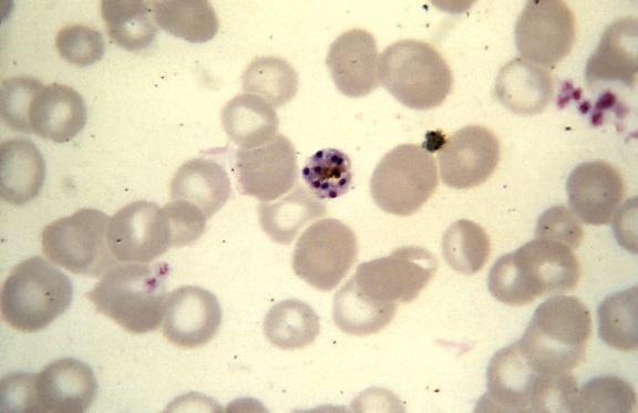 malariae, schizont, normal, størrelse