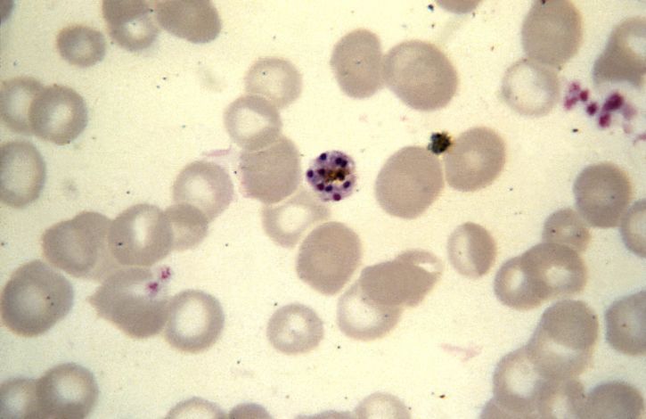malariae, schizont, normale, grootte