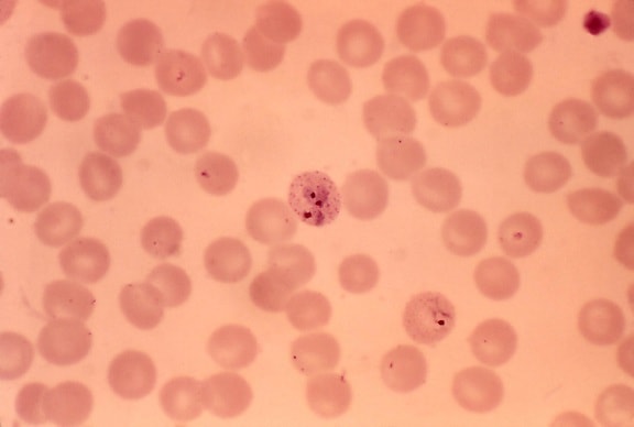 červených krviniek, normálny, normálny, veľké, okrúhle, dobre, schuffners, bodky, viacnásobné, parazity
