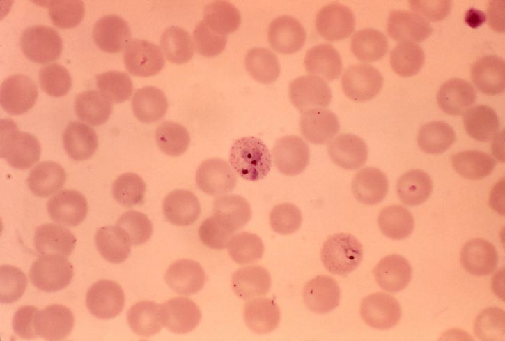 globuli rossi, normale, normale, dimensioni, rotondo, fine, schuffners, punti, più, parassiti