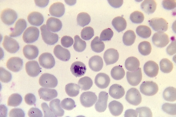 infekcie Plasmodium, rôznych buniek, stavovcov, mikroskopia