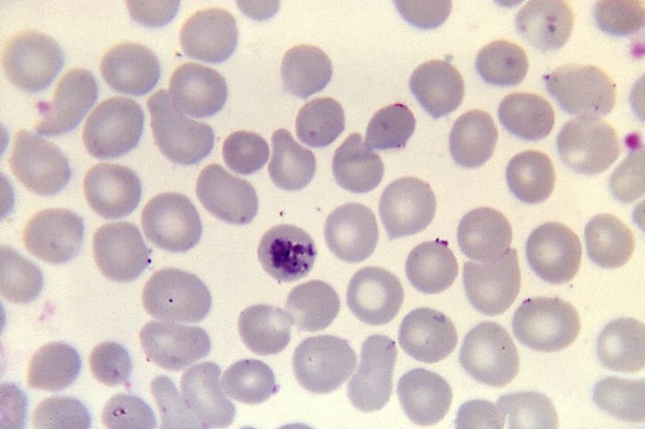 Plasmodium infektio eri solujen, selkärankaiset, mikroskopia