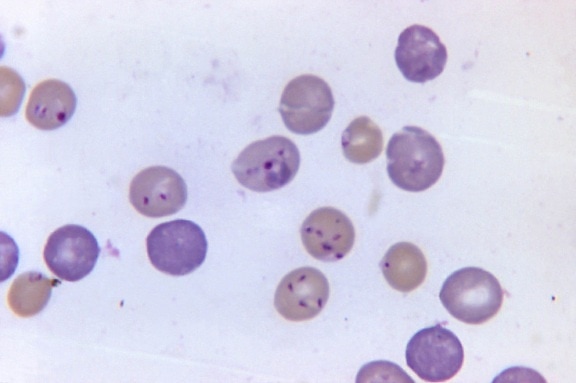 햄스터, 빨강, 혈액, 세포, babesia, microti, 변형 체 berghei, 탄 창, 1125 x