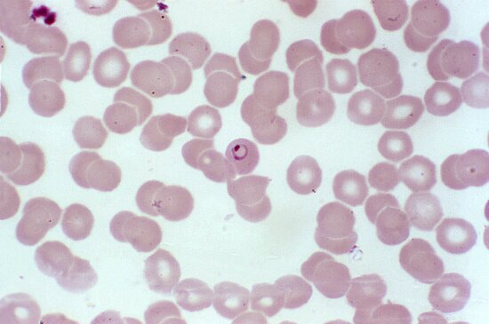 Free picture: thin, film, micrograph, ring, form, plasmodium vivax ...