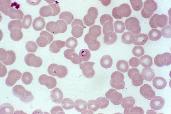 mája, parazity, zrelý, červeným krvinkám, schizont, gametocytes