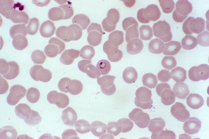 寄生虫、5 月、成熟した、赤血球、シゾント、gametocytes